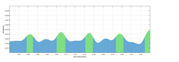 Klassifikation des Membranzustands über fünf Pumpvorgänge. Die Höhe der Balken zeigt die Frequenz-Amplitude bei 39,9 kHz.